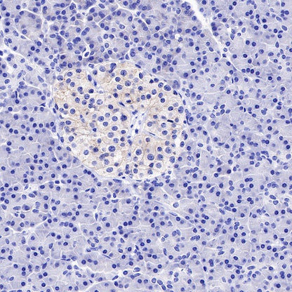 ROR1 Recombinant Rabbit mAb (SDT-R502-2)