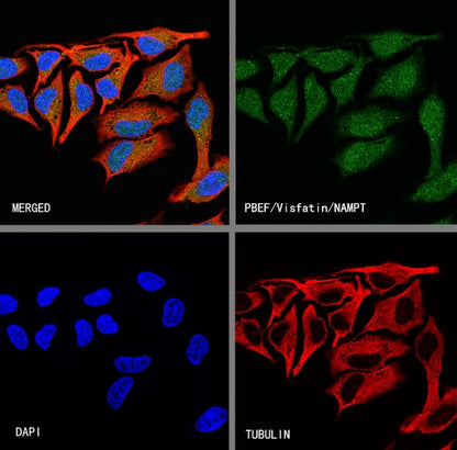 PBEF/Visfatin/NAMPT Rabbit Polyclonal Antibody