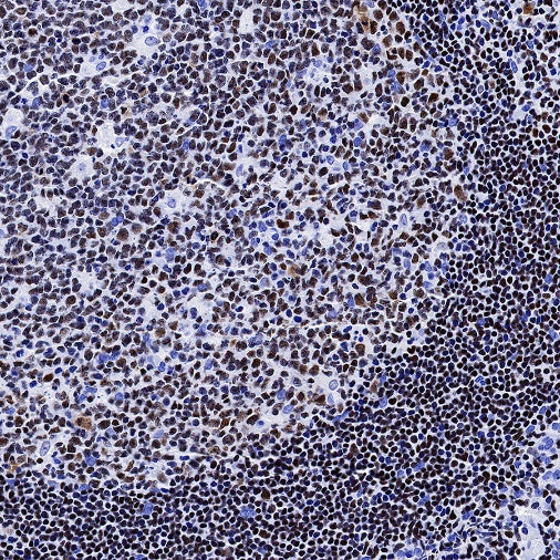AiolosI/KZF3 Recombinant Rabbit mAb (S-1268-42)
