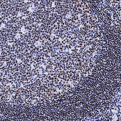 AiolosI/KZF3 Recombinant Rabbit mAb (S-1268-42)