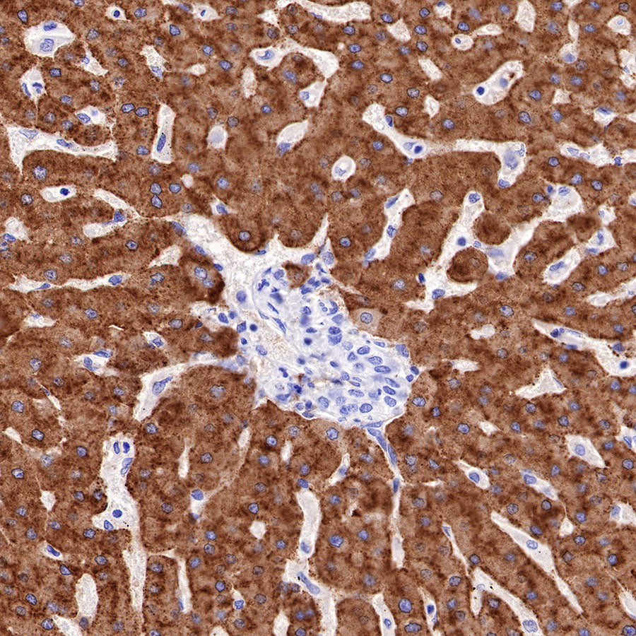 Asialoglycoprotein Receptor 1 Recombinant Rabbit mAb (SDT-292-48)