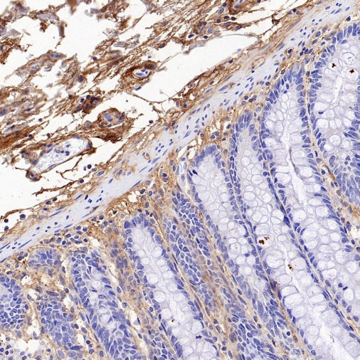Versican Recombinant Rabbit mAb (S-3770-43)