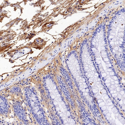 Versican Recombinant Rabbit mAb (S-3770-43)