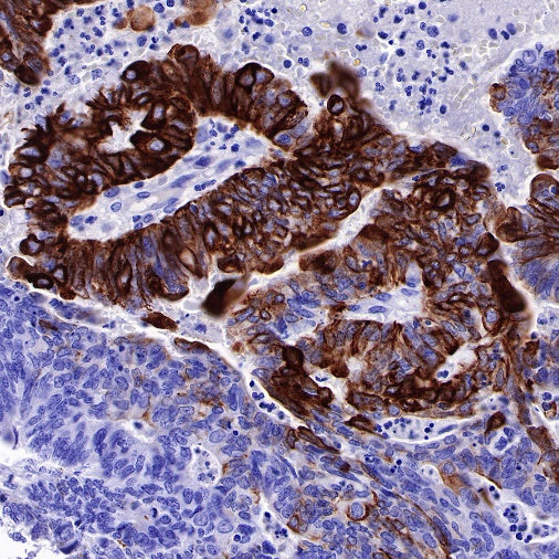 MUC4 Recombinant Rabbit mAb (SDT-R228)
