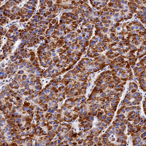SDHB Recombinant Rabbit mAb (SDT-1162-2)