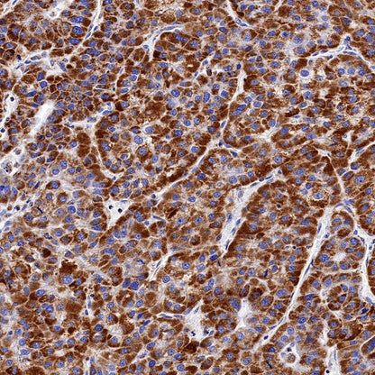 SDHB Recombinant Rabbit mAb (SDT-1162-2)