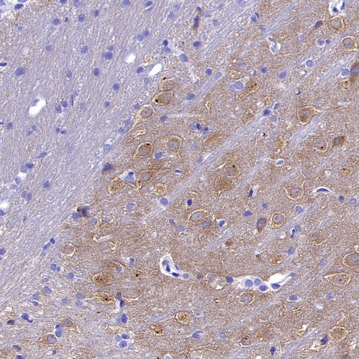 CaMKII alpha Recombinant Rabbit mAb (S-2451-54)