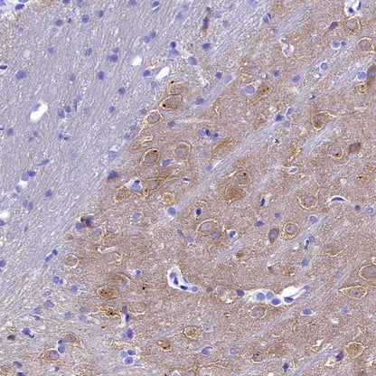 CaMKII alpha Recombinant Rabbit mAb (S-2451-54)