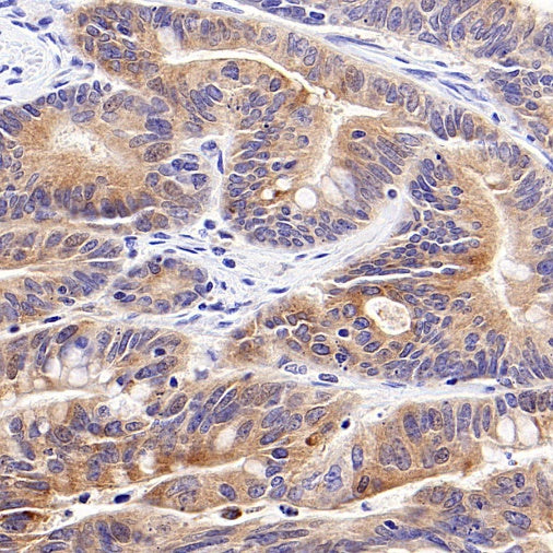 TIM-1 Recombinant Rabbit mAb (S-1555-147)