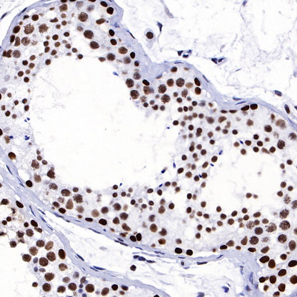 PARP1 Recombinant Rabbit mAb (S-R299)