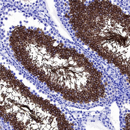 Hyaluronidase PH20/SPAM1 Recombinant Rabbit mAb (S-2143-20)