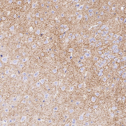 SLC6A1 Recombinant Rabbit mAb (SDT-2424-278)