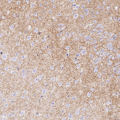 SLC6A1 Recombinant Rabbit mAb (SDT-2424-278)