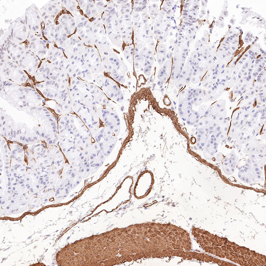 alpha smooth muscle Actin Recombinant Mouse mAb (SDT-R142)
