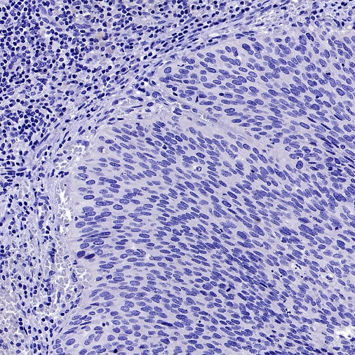 StAR Recombinant Rabbit mAb (S-2520-24)
