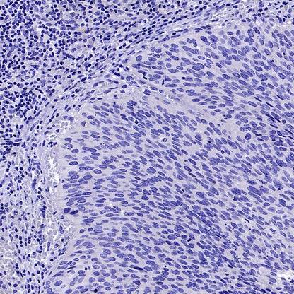 StAR Recombinant Rabbit mAb (S-2520-24)
