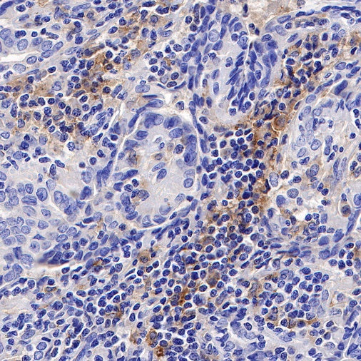 PD-L2 Recombinant Rabbit mAb (S-1041-21)