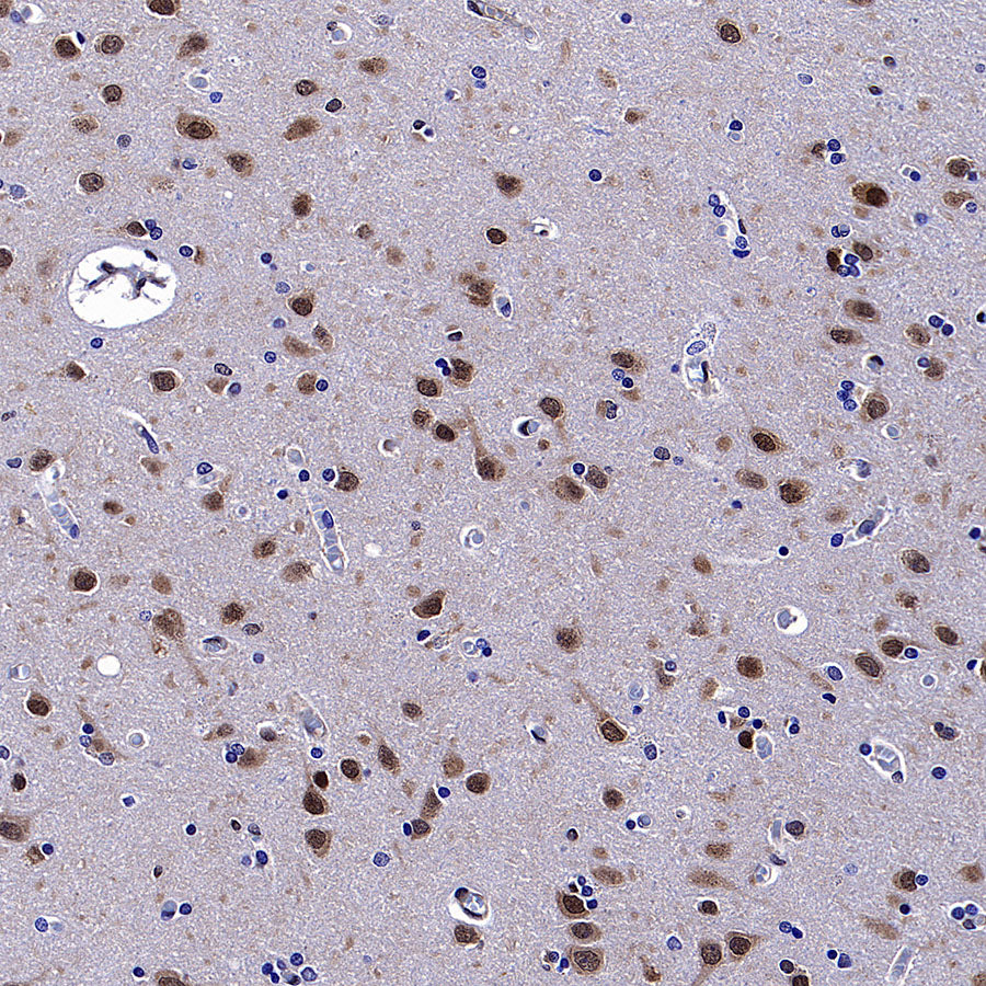 CNBP Recombinant Rabbit mAb (S-4288-3)