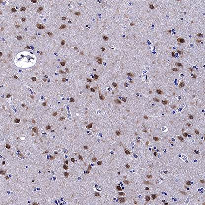 CNBP Recombinant Rabbit mAb (S-4288-3)
