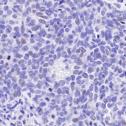 SAGE1 Recombinant Rabbit mAb (SDT-317-60)