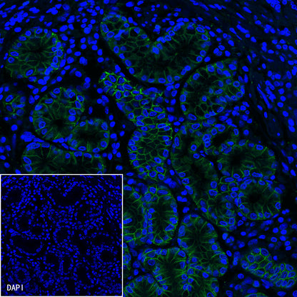 Claudin18.2 Recombinant Rabbit mAb,PBS Only (SDT-102-24)