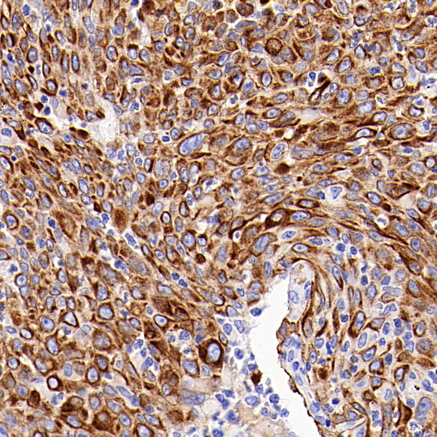SLC43A2 Recombinant Rabbit mAb (S-4492-33)