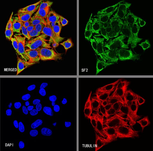 SF2 Recombinant Rabbit mAb (S-1845-27)