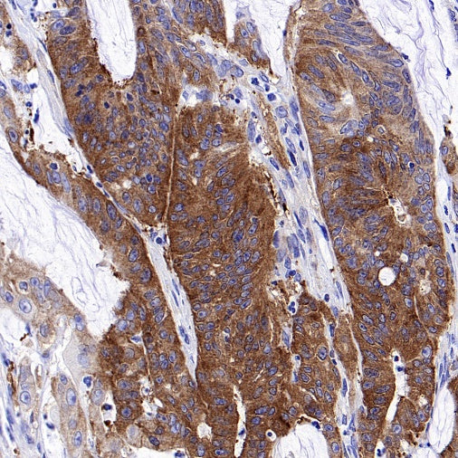 PRDM1/Blimp1 Recombinant Rabbit mAb (S-1972-3)