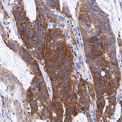 PRDM1/Blimp1 Recombinant Rabbit mAb (S-1972-3)