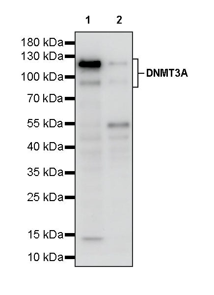 DNMT3A Recombinant Rabbit mAb (S-4120-54)