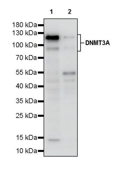 DNMT3A Recombinant Rabbit mAb (S-4120-54)