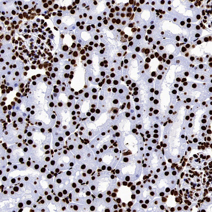hnRNP U Recombinant Rabbit mAb (S-2375-23)