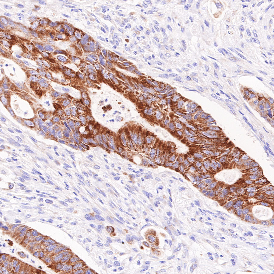 AMACR/p504s Recombinant Rabbit mAb (SDT-401-29)