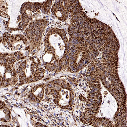 Fumarate hydratase Recombinant Rabbit mAb (SDT-2434-37)