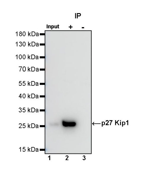 p27 Kip1 Recombinant Rabbit mAb (SDT-361-310)