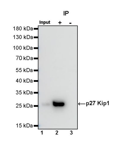 p27 Kip1 Recombinant Rabbit mAb (SDT-361-310)