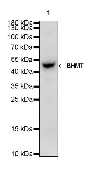 BHMT Recombinant Rabbit mAb (S-R286)