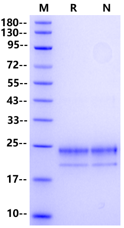 TRANCE/RANK L/TNFSF11 (159aa) Protein, Mouse (RAW264.7 Osteoclast-Specific)