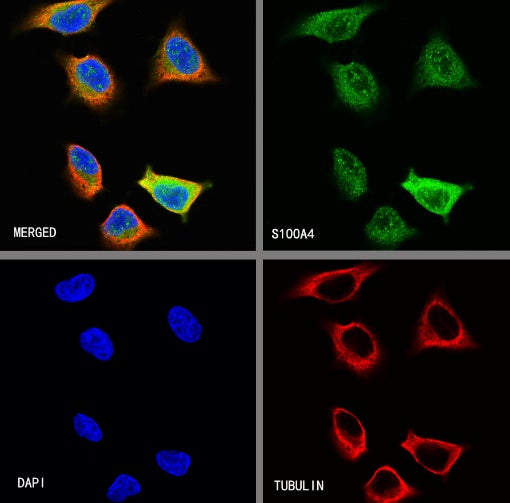 S100A4 Recombinant Rabbit mAb (S-1655-26)