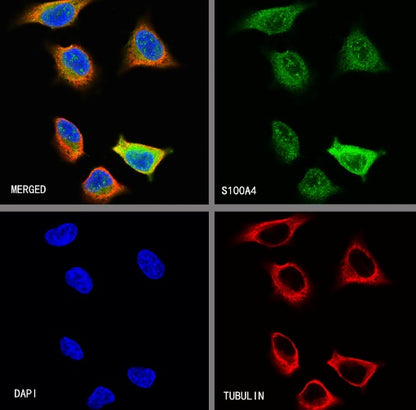 S100A4 Recombinant Rabbit mAb (S-1655-26)