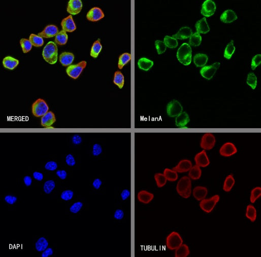 MelanA Recombinant Rabbit mAb (SDT-3352)