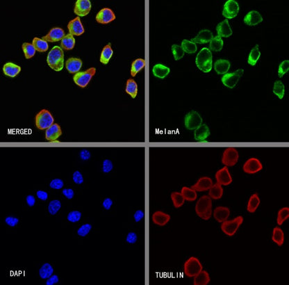 MelanA Recombinant Rabbit mAb (SDT-3352)