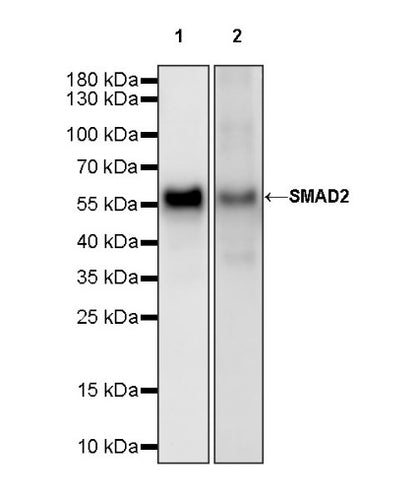 SMAD2 Recombinant Rabbit mAb (S-1420-20)