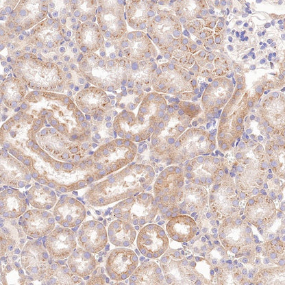 ATG9A Recombinant Rabbit mAb (S-1418-5)