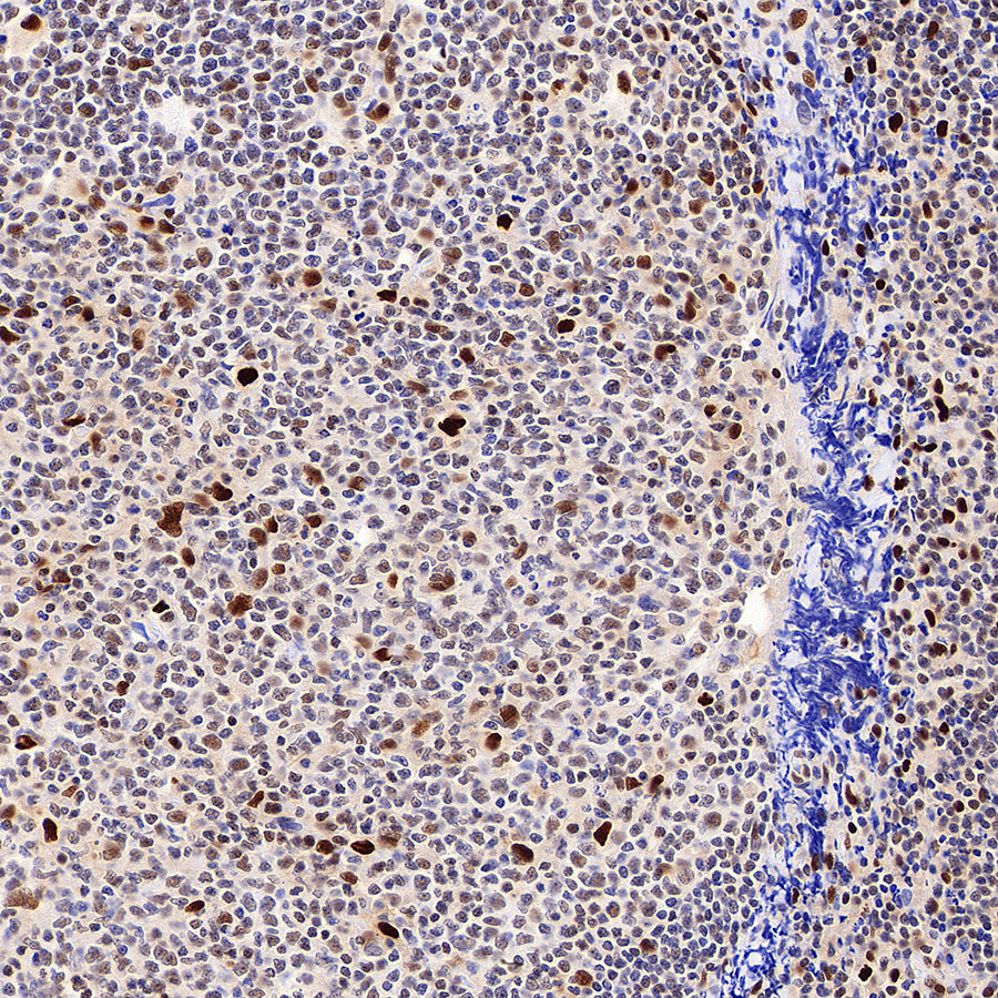 TBX18 Recombinant Rabbit mAb (S-4619-17)