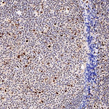 TBX18 Recombinant Rabbit mAb (S-4619-17)