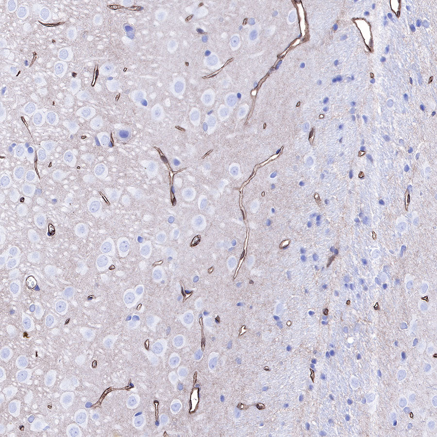 S-RMab® GLUT1 Recombinant Rabbit mAb (SDT-047-53)