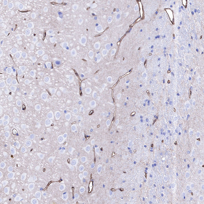 S-RMab® GLUT1 Recombinant Rabbit mAb (SDT-047-53)