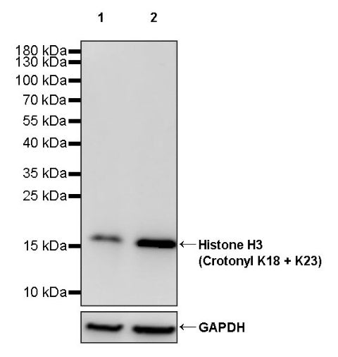Histone H3 (Crotonyl K18 + K23) Recombinant Rabbit mAb (S-R410)