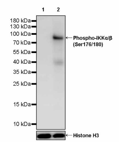 Phospho-IKKα/β (Ser176/180) Recombinant Rabbit mAb (S-4059)